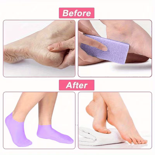 Silicone Gel Foot Care Socks - Reusable & Durable